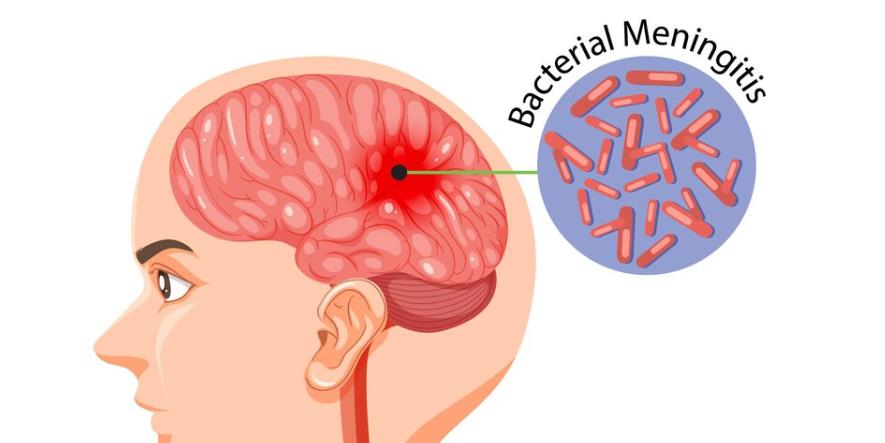 脑出血患者深度昏迷手突然动了是要苏醒吗